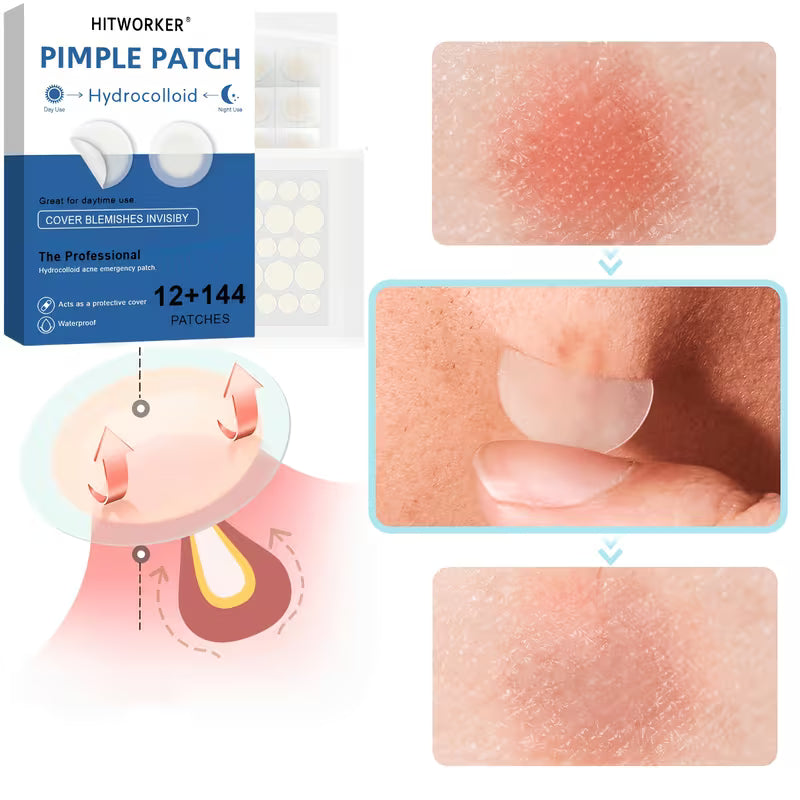 Parches anti-acné hidrocoloidales